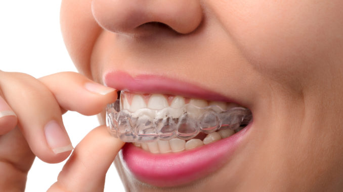 Invisalign Invisalign