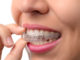 Invisalign